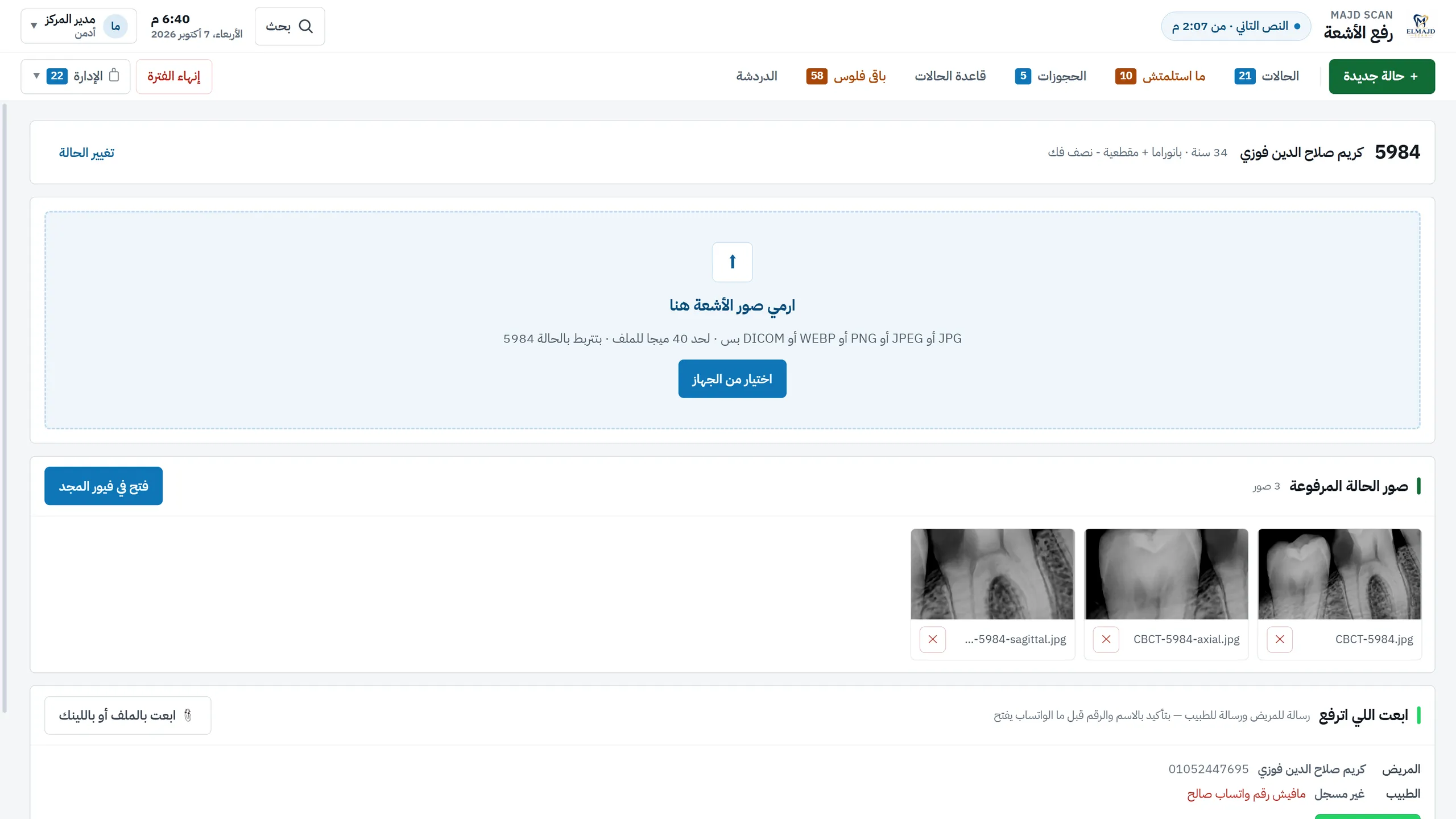 Uploading the X-rays